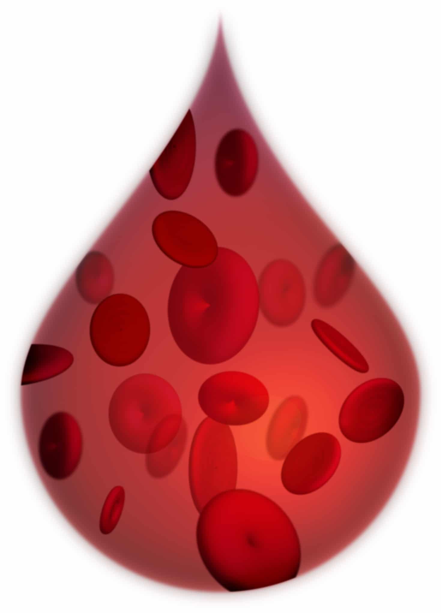 anemia